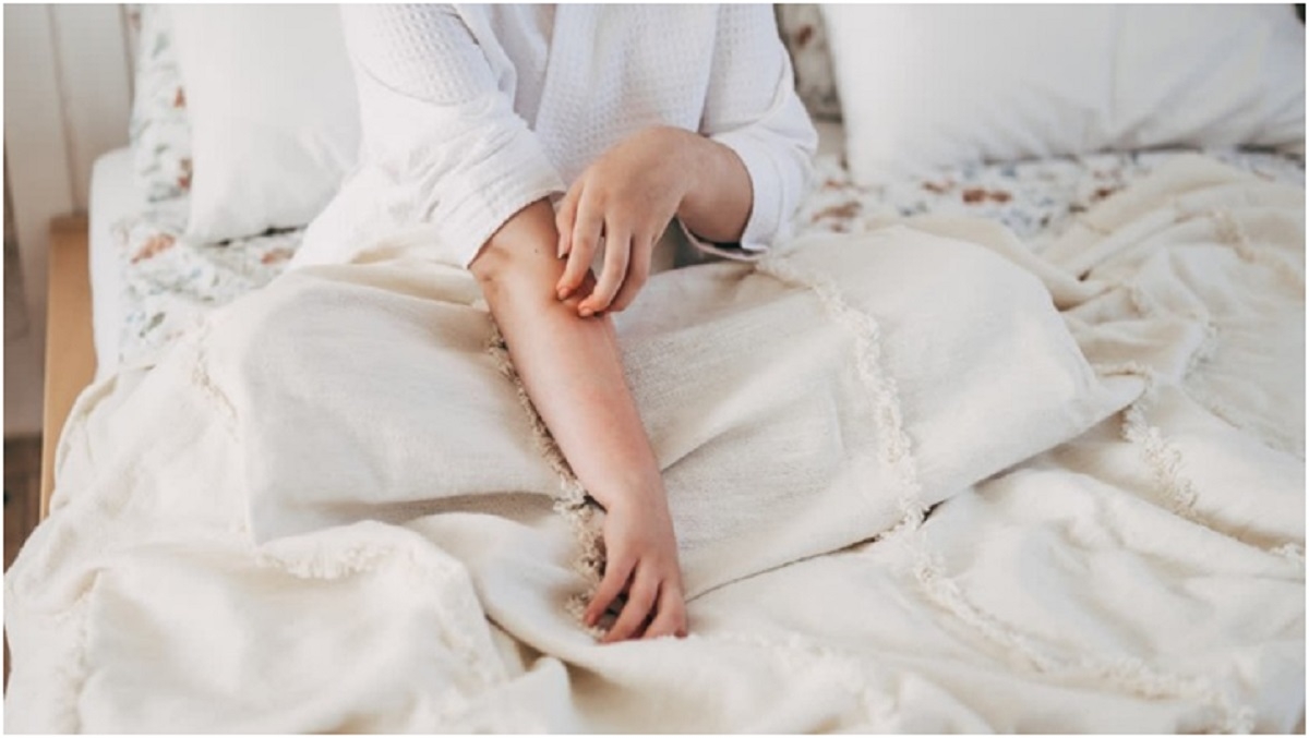 Simple Ways To Stop Eczema