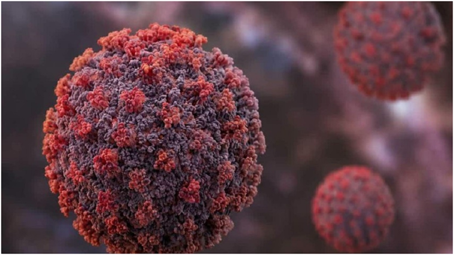 Repeated Flu And Covid-19 Infections Linked To Higher Parkinsons RiskC CMB Study Finds